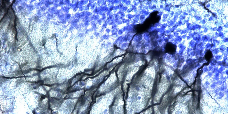 Una investigación liderada por la Complutense desarrolla un nuevo tratamiento para la fase aguda del ictus